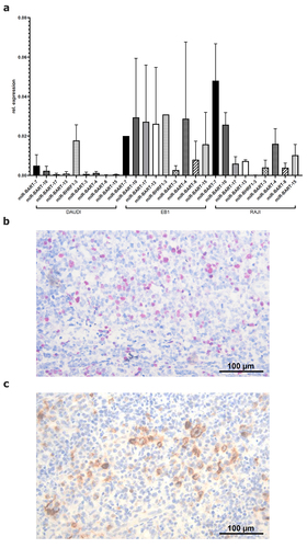 Figure 1. Expression and quantification of selected EBV-encoded factors in vitro and in vivo. (A) qPCR-based quantification of selected EBV-miRs in three EBV-positive cell lines. The relative copy numbers of the selected EBV-miRs were determined as described in Materials and Methods. The human endogenous hsa-miR-3960 served as housekeeping gene for calculation of the relative expression values, which are expressed as mean of three biological replicates. (B) representative EBER-CISH staining of an EBV-positive tonsil derived from a patient with infectious mononucleosis (sample ID: IM3). EBER-CISH staining was performed according to Materials and Methods. (C) representative anti-LMP1 immunohistochemistry staining of an EBV-positive tonsil derived from a patient with infectious mononucleosis (sample ID: IM3). LMP1 expression was determined by IHC using an anti-LMP1 antibody as described in Material and Methods.