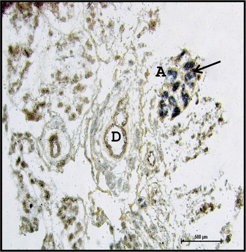 Figure 19. Photomicrograph of 40.5 cm CVRL (165th day) buffalo foetus showing the presence of phospholipids (arrow) in the cell membrane of acinar cells (A) and ducts (D) of the mandibular gland. Acid Haematin method ×40.