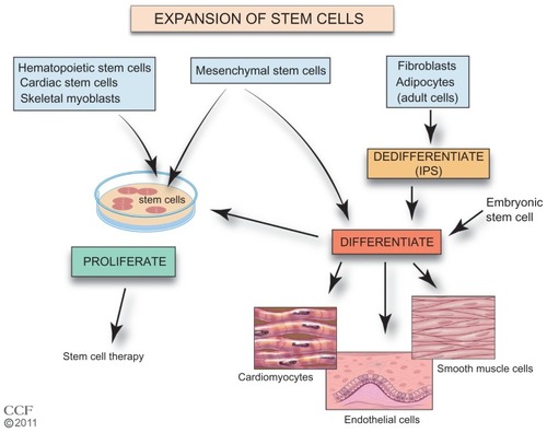 Figure 2 Expansion of stem cells.Reprinted with permission, Cleveland Clinic Center for Medical Art & Photography © 2011–2012. All Rights Reserved.