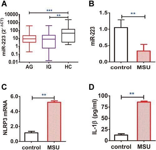 Figure 7 miR-223 level was down-regulated in peripheral blood mononuclear cells (PBMCs) from patients with gout. (A) miR-223 level was measured in PBMCs from patients with acute gout (AG, n=80), intercritical gout (IG, n=40) and healthy controls (HC, n=40). (B–D) The PBMCs from HC treated with MSU crystals (100 μg/mL) for 12 h in vitro were harvested for measurement of miR-223 (B), NLRP3 mRNA (C) and IL-1β protein (D) in the supernatant. The miRNA or mRNA level was detected by real-time qPCR, and the protein level was measured using ELISA. The results are representative of 3 independent experiments. n=3 for each group (B–D). One-way analysis of variance or the paired t-test, and the Bonferroni post-test were used for comparisons between the groups. **P<0.01. ***P<0.001.