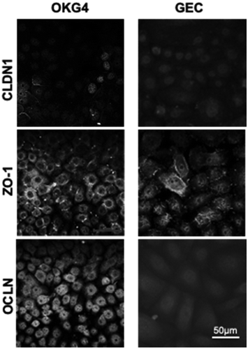 Figure A4. TJ strands are not formed in oral keratinocytes in the presence of a low Ca2+ concentration. 1.2 × 104 cells cultivated in the presence of 60 µM Ca2+ were fixed and stained for claudin-1, ZO-1 and occludin. Image processing was performed with ZEN and ImageJ. Scale bar, 50 µm.