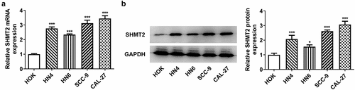 Figure 1. SHMT2 is up-regulated in OSCC cells. (a-b) The detection of SHMT2 mRNA and protein levels employed RT-qPCR and western blot in OSCC cell lines. *P < 0.05, ***P < 0.001 vs. HOK.