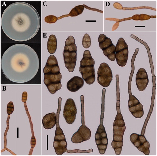 Figure 2. Morphological features of the fungus described in this work. (A) Colony characterization on PDA after 7 d. (B–D) Sporulation patterns on PCA. (E) Conidia (scale bars: B–E = 20 µm).