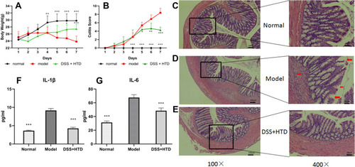 Figure 8 HTD ameliorates DSS-induced colitis. (A) Curve of daily Colitis scores. (B) Curve of daily body weights. (C) Colonic mucosa of normal group mice. (D) Colon of a DSS-treated mouse, severe inflammatory infiltration, edema, loss of crypts and ulcerations are seen. (E) HTD decreased DSS-induced colonic inflammation. (F and G) Effect of HTD on serum level of IL-1βand IL-6. Data are expressed as mean±SD (n = 8). *P < 0.05, **P < 0.01 and ***P < 0.001 versus model group.