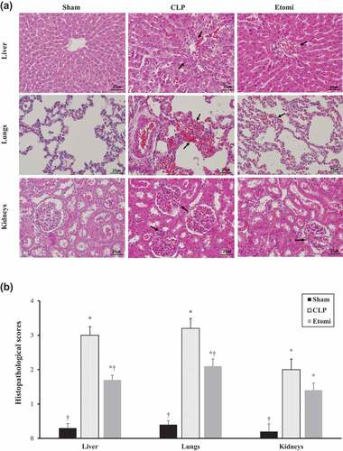 Figure 1. (a) Histopathologic changes in organs of CLP-induced septic rats. Hematoxylin and eosin-stained sections of liver, lungs and kidneys from rats subjected to sham/CLP operation 24 h after surgery (magnification ×400). Etomidate treatment attenuates acute organ injury by CLP-induced sepsis. (b) Quantification of the severity of inflammation in each organ (ranges from 0 to 4). *P<0.05 vs Sham, †P<0.05 vs CLP. Sham: sham operation group, CLP: Cecal ligation and puncture with normal saline group, Etomi: Cecal ligation and puncture with etomidate treatment group.