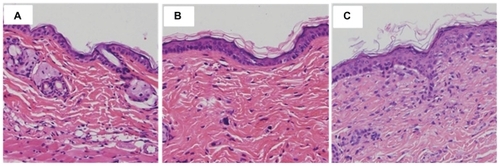 Figure 7 Microphotograph (200×) of vertical section of mouse skin after hematoxylin eosin staining: (A) untreated skin, (B) skin treated with quercetin propylene glycol solution, and (C) skin treated with quercetin-loaded NPs.