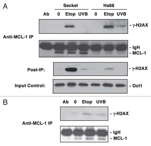 Figure 5 Association of MCL-1 and γ-H2AX is altered in ATR defective cells. (A) F02-98 cells (Seckel) or primary human fibroblasts (Hs68) were either untreated (0) or treated with etoposide (Etop) for 3 h or exposed to UVB radiation for 20 s and allowed to recover for 3 h. Total nuclear extracts were immunoprecipitated with anti-MCL-1 antibody and probed for γ-H2AX and MCL-1. Ab represents anti-MCL-1 antibody used in the absence of nuclear extracts. The lower parts indicate total nuclear extracts following immunoprecipitation, probed for non-immunoprecipitated γ-H2AX (Post-IP) and the Input Control was taken from the total nuclear extracts prior to immunoprecipitation and probed for Oct1 expression. (B) HT-144 cells (ATM-deficient) were either untreated (0) or treated with Etoposide (Etop) for 3 h or exposed to UVB radiation for 20 sec and allowed to recover for 3 h. Total nuclear extracts were immunoprecipitated with anti-MCL-1 antibody and probed for γ-H2AX and MCL-1. Ab represents anti-MCL-1 antibody used in the absence of nuclear extracts.