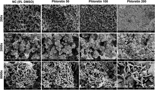Figure 2. Phloretin effect on S. mutans adherence to HA. Representative scanning electron microscopy images (SEM) of S. mutans biofilms treated with 50 μg/ml, 100 μg/ml and 200 μg/ml of phloretin compared to negative control containing 5% DMSO. Images were taken at ×200, ×2 000 and ×8000 magnifications.