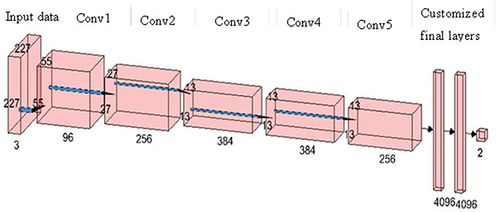 Figure 4 The proposed AlexNet architecture for binary classification.