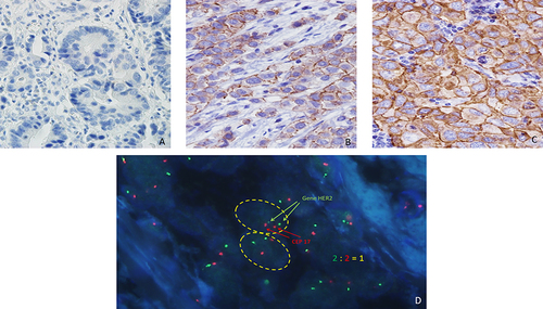 Figure 2 This figure displays exemplary images of HER2 status using Immunohistochemistry (IHC) and in situ hybridization (ISH).