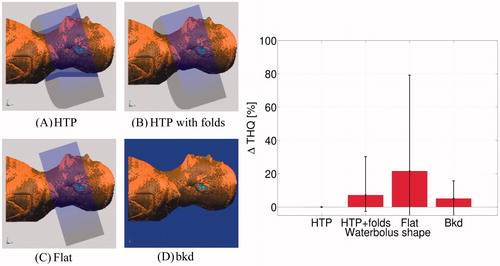 Figure 2. Left: Different water bolus shapes used in the applicator model to investigate the influence on treatment quality. (A) Hyperthermia treatment planning (HTP) shape, (B) HTP with realistic folds (five in total), (C) straight edges, (D) full water background. Right: Influence of water bolus shapes on target-to-hotspot quotient (THQ), compared to the THQ of the standard HTP model.