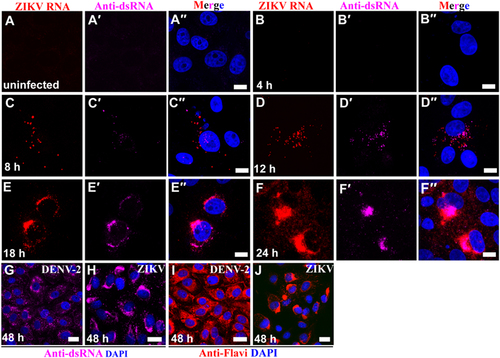 Fig. 1 ZIKV multiplies in perinuclear replication factories in vitro.(a–a′′) Vero 76 control cells (uninfected cells). (b–f′′) Vero 76 cells were infected with ZIKV African MR 766 strain and IFA/FISH-stained using a probe targeting the ZIKV genome (red) and J2 antibody against dsRNA (magenta) at the indicated time points. (g–j) Location of ZIKV perinuclear replication factories was  compared with even distribution of DENV-2 in the cytoplasm by staining of antibody J2 against dsRNA (magenta) and antibody against flaviviruses (red). Nuclei were stained with DAPI (blue). Scale bar, 10 µm (a–f′′) and 20 µm (g–j)