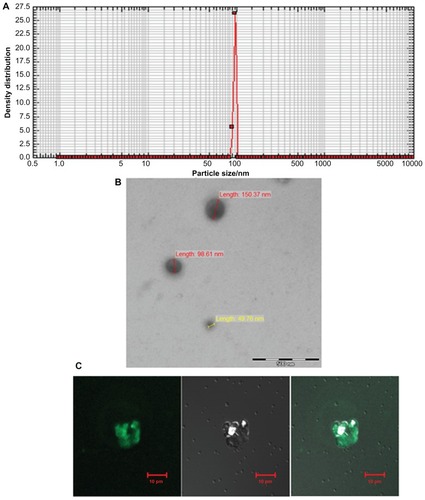 Figure 2 Characterization of archaeosomes and their interaction with macrophages. (A) Size of in-house prepared archaeosomes as determined by nanophox size analyzer (B) SEM image of archaeosomes and (C) interaction of archaeosomes with J774A.1 macrophages as visualized by confocal microscopy. The left panel shows a fluorescence microscopic image of archaeosomes entrapped in macrophages, a bright field image of the same is shown in the middle panel and the right panel represents superpositioning of left and middle panels.Abbreviation: SEM, scanning electron microscope.