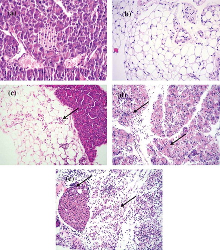 Figure 4. Histopathological changes in pancreas tissues of CVB4-E2 infected and control dams. (a) Absence of changes in the acinar and endocrine pancreas tissue (20×) and in the peripancreatic fat tissue (20×) (b) of a dam mock infected on day 4/E.4 sacrificed on day 3 p.i./E.7. (c) Focal infiltration in the peripancreatic fat tissue of virus-infected dam on day 10/E.10, sacrificed on day 3/E.13 p.i. (20×). (d) Pancreatitis in the acinar tissue showing inflammatory phase in the tissue of dam infected with the virus on day 4/E.4 sacrificed on day 3 p.i./E.7 (20×). (e) A stage of transition from acute to a subacute condition with reparative changes, lymphoplasmacytic inflammation with several incipient capillaries, and formation of inflammatory granulation in the defunct parenchymal pancreatic tissue. The lymphocytic infiltrates were also observed in the pancreatic islets of dams infected with the virus on day 10/E.10 (20×) and sacrificed on day 5 p.i./E.15.
