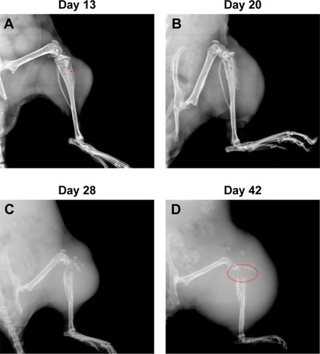 Figure 2 Radiographs indicated the impaired proximal tibias by OSA.