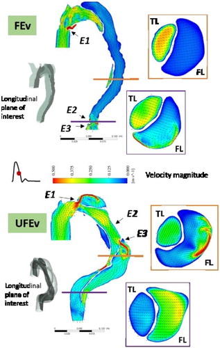 Figure 1. Velocity patterns during deceleration for FEv (top) and UFEv (bottom). Entry tear positions are identified by Ei (i = 1,2,3).