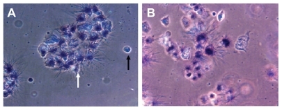 Figure 7 Qualitative morphological study of apoptosis by MTT assay. Phase contrast pictures of formazon in Ni NWs treated Panc-1 cells where (A) control, ie, untreated cells and (B) treated cells. Viable cells exhibited a deep purple cell nucleus with rod shaped formazon whereas apoptotic cells lacked formazon growth because of the lack of mitochondrial reductase and thus did not change in color. Dead cells are indicated by black arrows and live cells are identified by white arrows.