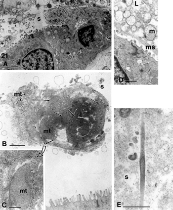 Figure 27 Hypothesis of sequential epithelium histopathological changes.