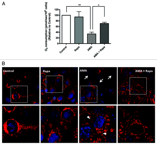 Figure 6. Rapamycin protects against AMA-induced mitochondrial depolarization and respiration dysfunction in HL-1 cardiomyocytes. (A) Cells were pretreated with vehicle control or 1 µM rapamycin for 16 h, followed by treatment with 50 µM AMA for an additional 24 h, in the absence or presence of rapamycin. Cells were subsequently trypsinized, resuspended in Claycomb media and routine respiration analyzed. Data are derived from three independent experiments. *p < 0.05; **p < 0.01. (B) Cells were pretreated with vehicle control or 1 µM rapamycin for 16 h, followed by incubation with 50 µM AMA for an additional 24 h, in the absence or presence of rapamycin. Cells were subsequently stained with 50 nM TMRM and imaged using epifluorescence microscope. Representative images are shown. Arrows represent cells with no Δψm. Arrowheads represent swollen mitochondria. Rapa; rapamycin.