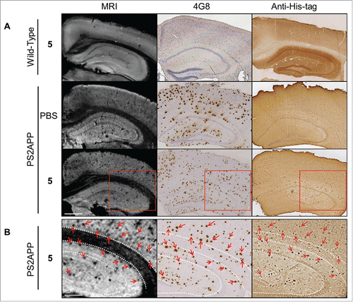 Figure 5. In vitro MRI revelation of amyloid deposits by the contrast agent R3VQ-S-(DOTA/Gd)3 5. (A) PS2APP or wild-type (amyloid free) brains were incubated with PBS or 5 before MRI acquisitions (left frames). IHC were realized with 4G8 antibody as a reference anti-beta amyloid antibody (middle frames), or an anti-His-tag antibody to reveal the amyloid deposits labeled by the contrast agent 5 (right frames). MRI acquisitions were performed with a 25 µm isotropic resolution (n = 2/group). Red squares show the magnified areas used for the registration. Scale bar = 500 µm. See Fig. 6 for hypointense spots quantification. (B) Registration was done between MRI, 4G8 and anti-His-tag IHC on PS2APP tissues incubated with 5. Hypointense spots on MR images correspond to amyloid deposits labeled by 5 on the anti-His-tag IHC and by 4G8 (red arrows). White dotted lines represent landmarks that delimited the corpus callosum and the hippocampus. Scale bar = 250 µm.