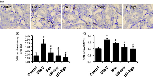 Figure 7. Renal OPN expression in diabetic rats treated with vehicle, benazepril or leflunomide for 8 weeks. (A) Representative images showing OPN staining in the kidney (Magnification = 400X). (B) OPN staining intensity quantified using ImageJ. (C) Renal OPN mRNA levels determined by real-time PCR. DM, diabetes mellitus group; V, vehicle; Ben, benazepril; LEF, leflunomide. Values are mean ± SEM; * p < 0.05 versus control, #p < 0.05 versus vehicle-treated DM rats.