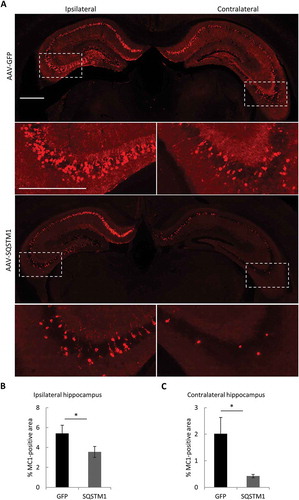 Figure 7. Overexpression of SQSTM1 attenuates pathological MAPT spreading. PS19 P0 pups were injected with AAV-GFP or AAV-SQSTM1, and at 2–3 months of age, 2 μl of MAPT brain lysate were stereotaxically injected into one hippocampal hemisphere (bregma, −2.5 mm; lateral, −2 mm, and depth, −1.8 mm). The mice were euthanized 2 months later for mutant MAPT spreading analysis. (a) Representative MC1-positive immunofluorescence images of ipsilateral and contralateral of hippocampus of PS19 mice injected with AAV-GFP or AAV-SQSTM1 and inoculated with MAPT lysates. The higher magnification views of bracketed areas are shown underneath each panel. (b and c) Quantitative analysis of MC1-positive areas in ipsilateral (b) or contralateral (c) hippocampus of AAV-GFP- or AAV-SQSTM1-treated PS19 mice. n = 9/group. Scale Bar: 1000 μm. Data are expressed as mean ± SEM. *P ≤ 0.05.