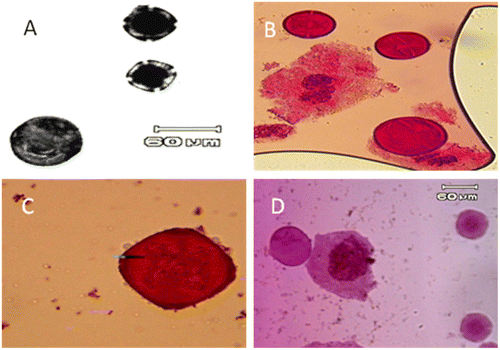 Figure 7. Potential unreduced (2n) pollen grain (large size pollen) in: (A) A. italica var. italica (Dizin population); (B) A. italica var. kurdica (Kamyaran population); (C) A. strigosa; (D) A. arvensis subsp. orientalis (scale bar = 60 μm).