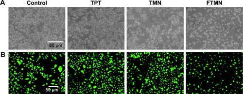 Figure 7 (A) Morphological imaging of Y79 cancer cells after treatment with TPT, TMN, and FTMN; (B) live dead assay of Y79 cancer cells after treating with respective formulations.Abbreviations: TPT, topotecan; TMN, TPT-loaded mesoporous silica nanoparticles; FTMN, TPT-loaded mesoporous silica nanoparticles surface conjugated with folic acid.