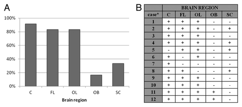 Figure 2. (A) Percentage of samples from certain brain region of 12 sCJD cases, which were defined as positive. (B) Results of PrP226* assay for all sCJD cases. Sequential numbers of samples are as in