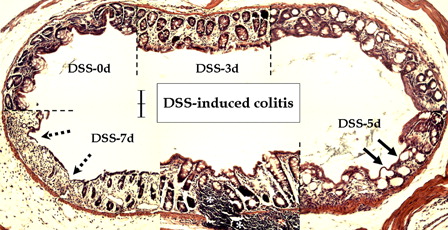 Figure 2. Microscopic features of DSS-induced colitis in young rats. Compared to the control (DSS-0d), DSS treatment caused degenerative changes in the mucosal layer in a time-dependent manner. Note compensatory hyperplasia on days 3 (DSS-3d) and 7 (DSS-7d), flat dysplasia (arrows) on day 5 (DSS-5d), and ulcerative changes (dotted arrows) and infiltration of inflammatory cells in the lamina propria (asterisks) at day 7 after DSS treatment. Scale bar = 100 µm.