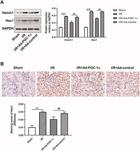 Figure 6. PGC-1α overexpression decreases Notch1 and Hes1 expression in kidney. (A) Western blot analysis of Notch1 and Hes1 expression in different groups; (B) Immunohistochemical staining of Hes1 in different groups. **p < 0.01 versus sham group; ## p < 0.01 versus I/R + Ad-control group.