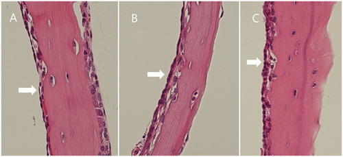 Figure 6. Middle ear mucosa (arrow) at 1 week after the operation. Compared with the negative control (A), the nanoparticle (C) and sham operation (B) groups showed a swollen and thickened mucosa.