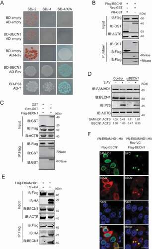 Figure 5. BECN1 is involved in Rev-mediated equine SAMHD1 degradation. (A) Yeast two-hybrid analysis of EfBECN1 and Rev. The indicated plasmids were co-transformed into the Y2HGold yeast strain. (B) GST affinity-isolation analysis of EfBECN1 and Rev. Flag-BECN1 was co-transfected with VR-GST or Rev-GST. Whole-cells lysates were prepared, and GST affinity isolations were performed with glutathione magbeads and analyzed using western blotting. (C) Co-IP analysis of EfSAMHD1 and Rev. HEK293T cells were transfected with indicated plasmids. Whole-cell lysates were prepared at 48 hpt, and immunoprecipitations were performed with anti-Flag beads and analyzed using western blotting. (D) Knockdown of EfBECN1 blocks EIAV-induced EfSAMHD1 degradation. eMDMs were transfected with BECN1-specific siRNA or scrambled siRNA control. At 48 hpt, eMDMs were infected with EIAVDLV36. BECN1 and EfSAMHD1 protein levels were visualized using western blotting after additional 24 h. The densities of EfSAMHD1 and BECN1 bands were analyzed to calculate the values relative to that of ACTB. Results were normalized to uninfected cells of control group. (E and F) BECN1 is recruited to the SAMHD1-Rev complex. (E) Flag-EfSAMHD1 was transiently expressed with or without Rev-HA in HEK293T cells. At 48 hpt, anti-Flag immune complexes were immunoblotted against endogenous BECN1 and ectopically expressed SAMHD1 and Rev. (F) Flag-BECN1 was co-transfected in HeLa cells with the VN-EfSAMHD1-HA and Rev-VC pair or with VN-EfSAMHD1-HA alone. Ectopic BECN1 was stained with rabbit anti-Flag antibodies, followed by Alexa Fluor 647-conjugated secondary antibodies. Colocalization of these fluorescent signals was visualized by confocal microscopy. Scale bar: 20 μm