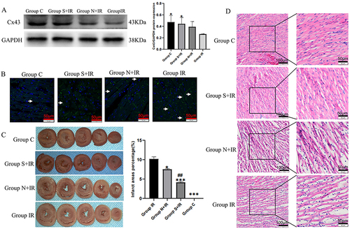 Figure 7 Effects of CFs-Exo and Sev-CFs-Exo on Cx43 and myocardial ischemia-reperfusion injury. (A and B) The relative expression and location of Cx43 in the four groups assessed by Western blotting assay and immunofluorescence, Cx43 is stained green with FITC, while the nucleus is dyed blue with DAPI, and the lateral Cx43 is as indicated by the arrow. (C) 2, 3, 5 – Triphenyl tetrazolium chloride staining determined myocardial infarct size. (D) Hematoxylin-Eosin staining evaluated changes in myocardial morphology. *vs group IR, #vs group N+IR. Data from n = 3 hearts. ##P<0.01, ***P<0.001.