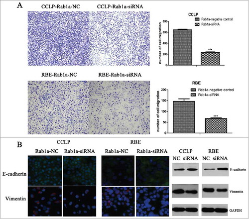 Figure 3. Suppression of Rab1a inhibits migration ability of CCA cell lines by hindering progression of EMT (A) showed results of transwell assay in RBE-Rab1a-siRNA, RBE-Rab1a-NC,CCLP-Rab1a-siRNA and CCLP-Rab1a-NC cells, and these results were quantified respectively,***means P < 0.0001 (B) Expression change of E-cadherin and Vimentin in RBE and CCLP cells under condition of Rab1a siRNA and negative were detected by immunofluorescence and western blot, GAPDH was as the internal control.