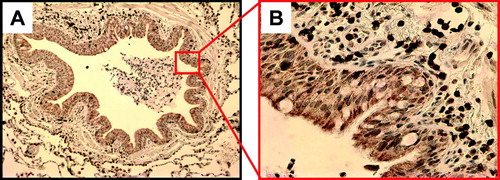 Figure 2 (A) Representative small airway stained for CD3, at 100x. (B) Quadrant of small airway, seen at 400x.