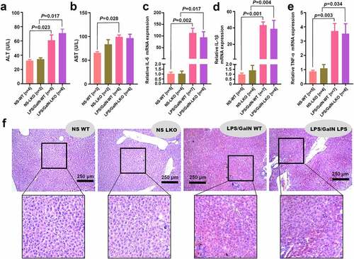 Figure 6. Effect of SND1 hepatocyte-specific deletion on acute liver failure induced by LPS/D-GalN