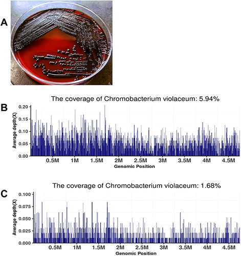 Figure 3 (A) Blood specimens were cultured for Chromobacterium violaceum by general bacteriophage culture. (B) Blood samples were tested by next-generation sequencing (NGS) on August 21, 2022, and Chromobacterium violaceum was detected. (C) Tissue samples confirmed Chromobacterium violaceum, with Next-Generation Sequencing (NGS) on August 24, 2022.
