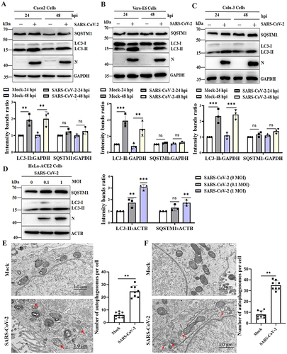 Figure 1. SARS-CoV-2 infection induces the accumulation of autophagosomes. Caco2 cells (A), Vero-E6 cells (B) and Calu-3 cells (C) were infected with SARS-CoV-2 at an MOI of 0.01, and cell lysates were collected at 24 and 48 hpi. The viral N protein was used as an indication of viral infection. GAPDH was used as a loading control. (D) HeLa-ACE2 cells were infected with SARS-CoV-2 at MOIs of 0, 0.1 and 1 for 24 h. The viral N protein was used as an indication of viral infection. ACTB was used as a loading control. The relative protein expression levels were quantified by densitometry analysis of at least three independent replicates. Error bars represent standard deviations of the means (n = 3). Ns, p > 0.05; **, p < 0.01; ***, p < 0.001. Autophagy confirmation by TEM in Caco2 cells (E) and Vero-E6 cells (F) was either mock infected or infected with SARS-CoV-2 (MOI, 0.01). After 24 h, the cells were collected, prepared into ultrathin sections and imaged under TEM. TEM showed the presence of double membrane vacuoles identified as autophagosomes in SARS-CoV-2-infected cells (arrowheads). Scale bars: 1.0 μm. The bar graph showed quantitative analysis of the number of autophagosomes observed by TEM in infected cells compared to noninfected cells. Autophagic vacuoles were counted from eight randomly selected fields. Values were expressed as the mean ± SD. **, p < 0.01.