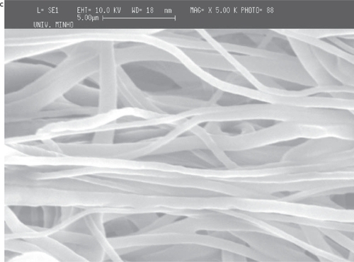 Figure 7 Deposition of PCL fiber meshes in a metallic wire net: a) macroscopic pattern of the fiber mesh, b) region of agglomeration of aligned fibers surrounded by random fibers and c) aligned fibers