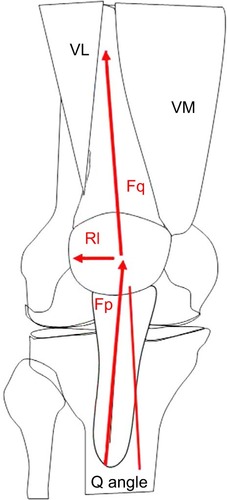 Figure 3 Schematic drawing showing the Q angle.