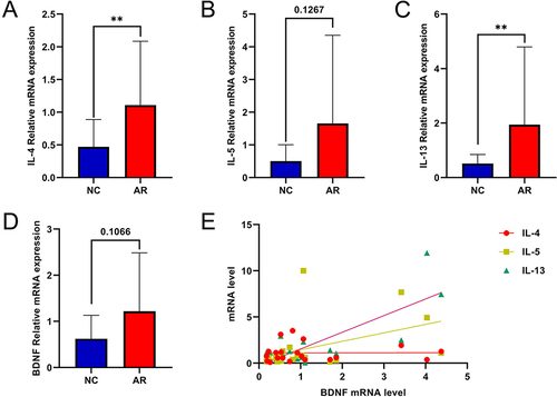 Figure 3 mRNA expression levels of BDNF and associated factors in AR and NC tissue. (A–D) mRNA levels of IL-4, IL-5, IL-13 and BDNF were detected by qRT-PCR. (E) The correlation with type II inflammation cytokines and BDNF. All data were analyzed by GraphPad 8, and statistical significance was detected by the Student’s t-test, correlations were analyzed by compute Pearson correlation coefficients. ns Means “no significant”, **Means p<0.01.