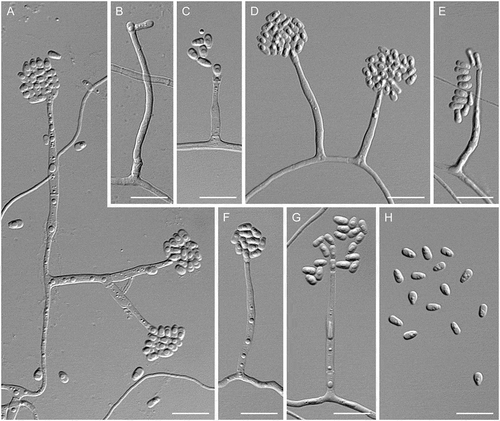 Figure 7. Entimomentora hyalina. A–G. Phialides with conidia (MLA slide culture, 13–17 d). H. Conidia (MLA, 10 d). A–D, H from CBS 177.74; E–G from CBS 130.74. Bars = 10 μm.