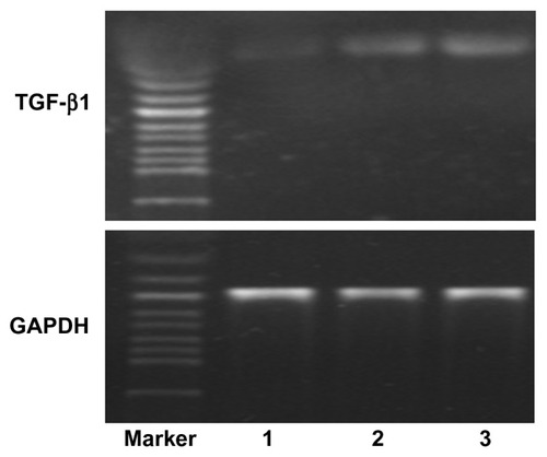 Figure 11 Messenger RNA expression of TGF-β1 in mesenchymal stem cells (MSCs).Notes: Well 1, MSCs transfected with free pTGF-β1; well 2, MSCs transfected with Lipofectamine™ 2000/pTGF-β1; well 3, MSCs transfected with CPEPS-pTGF- β1 nanoparticles.Abbreviations: TGF-β1, transforming growth factor beta-1; CPEPS, cationized Pleurotus eryngii polysaccharide; pTGF-β1, plasmid encoding TGF-β1; GAPDH, glyceraldehyde 3-phosphate dehydrogenase.