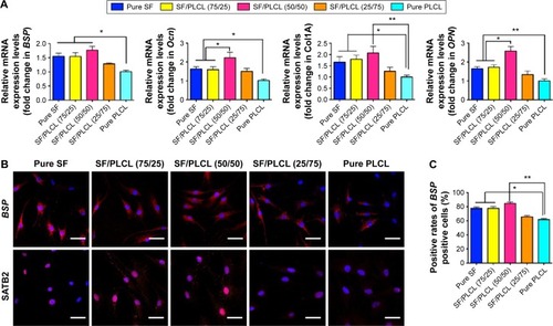 Figure 4 Osteogenesis of hADSCs on SF/PLCL nanofibrous scaffolds of different weight ratios.Notes: (A) qPCR results showed that the mRNA expression levels of osteogenic-specific genes such as BSP, Ocn, Col IA and OPN were elevated in the pure SF, SF/PLCL (75/25), and SF/PLCL (50/50) groups, compared with the pure PLCL group. All data are averages from three independent experiments (*P<0.05, **P<0.01). (B) Cellular immunochemistry imaged by CLSM showed that the expression levels of BSP and SATB2 were higher in the pure SF, SF/PLCL (75/25), and SF/PLCL (50/50) groups, compared with the other two groups. Scale bars: 100 μm. Positive cell ratios of (C) BSP and (D) SATB2 were determined by dividing the number of immune-positive cells by the number of nuclei stained with Hoechst; 700–1,000 cells were counted in a random field for each group. All data are averages from three independent experiments. *P<0.05, **P<0.0l. (E, F) Western blot results showed that the protein expression levels of osteogenic-specific genes such as OPN, BSP, and Ocn were significantly upregulated in the pure SF, SF/PLCL (75/25), and SF/PLCL (50/50) groups, compared with the pure PLCL group. All data are averages from three independent experiments, normalized to the internal control β-actin. *P<0.05, **P<0.0l.Abbreviations: CLSM, confocal laser microscope; hADSCs, human adipose-derived stem cells; PLCL, poly(lactide-co-e-caprolactone); qPCR, quantitative polymerase chain reaction; SF, silk fibroin.