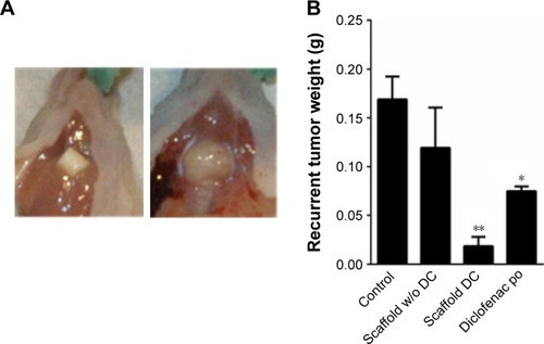 Figure 4 Effect of local release of diclofenac on recurrent tumor weight.Notes: (A) Left: Representative image of a mouse following termination of the experiment showing diclofenac-releasing scaffold. Right: Mouse from untreated group showing recurrent tumor. (B) Weight distribution of recurrent tumors in the different experimental groups. The lowest average weight was observed in mice implanted with diclofenac-releasing scaffolds. The administration of the drug was stopped at day 10 in mice taking diclofenac po, due to severe side effects. Control n=8, scaffold without diclofenac n=9, diclofenac-loaded scaffold n=3, and diclofenac po n=4. *P<0.05, **P<0.01.Abbreviation: DC, diclofenac.