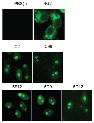 Figure 1 Indirect immunofluorescence assay of anti-DENV-2 reacted with the nuclear protein of DENV-2 infected cells.