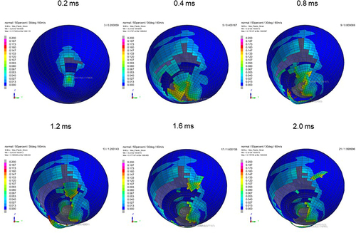 Figure 8 Sequential strain strength response of ocular surface of model eye upon airbag impact in 30°-gaze down position at 60 m/s with adhesion strength of scleral flap of 50%, shown at 0.4-ms intervals after 0.2 ms. Strain strength change is displayed in color as presented in the color bar scale (Figure 2).