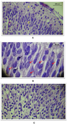 Figure 3. Histological changes of the cellular layers of the cerebral cortex among the three study groups as compared to the control group (using Eosin and Haematoxylin stain). A: Study group A: Abnormal cell shapes in the molecular layer (1) and external granular and pyramidal layer (2) (40X). B: Study group B: Pyramidal cell layer defects, reduced cell volume (red arrows), and apoptotic cells (black arrows) (100X). C: Study group C: Inner layer defects with numerous apoptotic cells and lost parenchymal structure (40X).