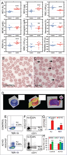Figure 1. Ablation of cyclin A2 in erythroid cells in vivo using erythropoietin receptor promoter-driven Cre leads to defective erythropoiesis. (A) Complete blood count data from cyclin A2fl/fl ErGFPcre mice (A2 KO, red dots, n = 11) and littermate controls (Control, blue dots, n = 9) at 3 months of age. (B-C) May-Grünwald Giemsa stained blood smears. Scale bar = 10µm. Arrows indicate erythrocytes with Howell-Jolly bodies. (D) 3D reconstruction of erythrocyte volume using z-stacks from confocal microscopy of blood smears stained with fluorescence-labeled PKH26. Representative wild-type erythrocytes (left panel, blue, inset density diagram in the middle); A2 KO (middle panel, red, inset density diagram in the middle [yellow plane indicates the cut of the inset]; and merge (right panel, inset representing 3D-view); indicating the difference in volume between wild-type and A2 KO erythrocytes. (E-F) Representative flow cytometry analysis plots of peripheral blood from age-matched control (top) and A2 KO (bottom) mice stained with antibodies against TER119 and CD71, and Hoechst33342 (n = 3). The percentage of TER119+ erythrocytes with nuclear remnants (Howell-Jolly bodies, HJ) is indicated in panel E. CD71 versus Hoechst plots for TER119+-gated peripheral blood cells with the frequencies of CD71+Hoechst− reticulocytes (RET) and CD71−Hoechst+ erythrocytes with Howell-Jolly bodies (HJ) are shown in panel F. (G) Bar graphs representing flow cytometry quantification of the percentage of erythrocytes containing Howell-Jolly bodies (HJ) in peripheral blood gated as shown in panel E, and the percentage of reticulocytes (RET) in TER119+-gated peripheral blood cells gated as shown in panel F (n = 3). (H) The mean forward scatter values of TER119+Hoechst−CD71 erythrocytes (RBC, red bars), TER119+Hoechst−CD71+ reticulocytes (RET, green bars), and TER119+Hoechst+CD71 Howell-Jolly bodies (HJ, blue bar) in the peripheral blood, gated as shown in panel F (n = 3). The forward scatter histogram overlays are shown in Figure S1C. Error bars represent standard deviation. Two-tailed t-test results are indicated by asterisks. *, p < 0.05; **, p < 0.01; ***, p < 0.001.
